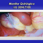 monitor-lg-32hl710s-systemdissa