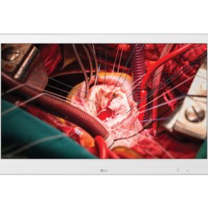 monitor quirúrgico LG 27HK510S
