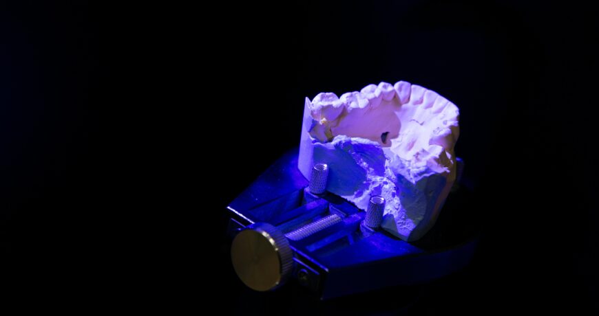 systemdissa_filamentopla